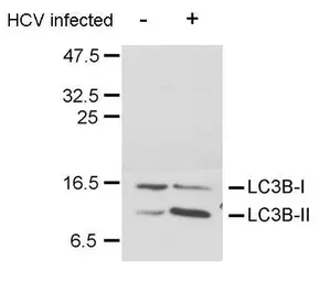 Anti-LC3B antibody used in Western Blot (WB). GTX127375